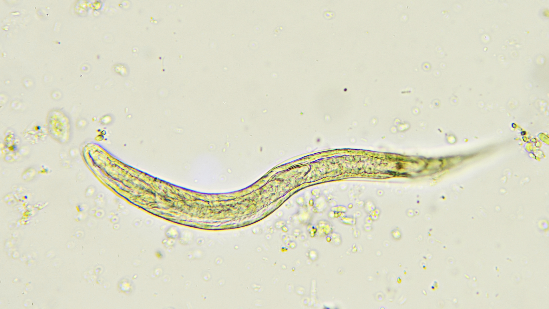 Hamilelikte Kıl Kurdu