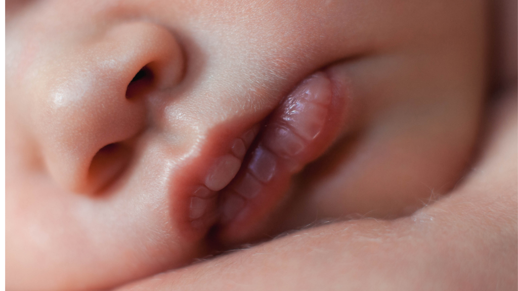 bebeklerde dudak morarması