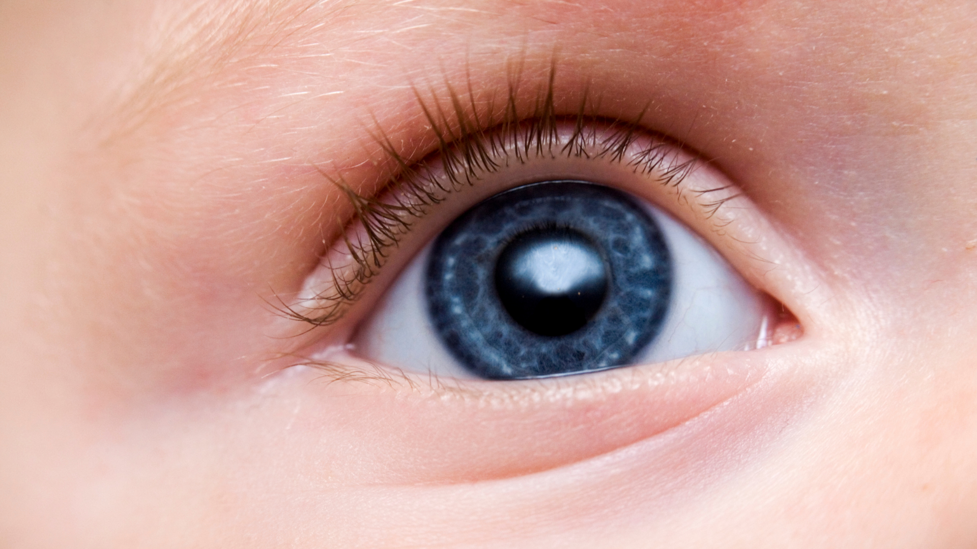 Bebeklerde Göz Torbası Neden Olur