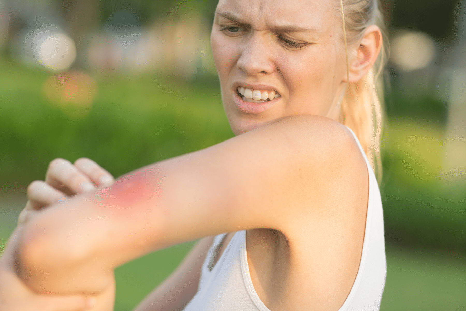 Hamilelikte Sivrisinek Isırması