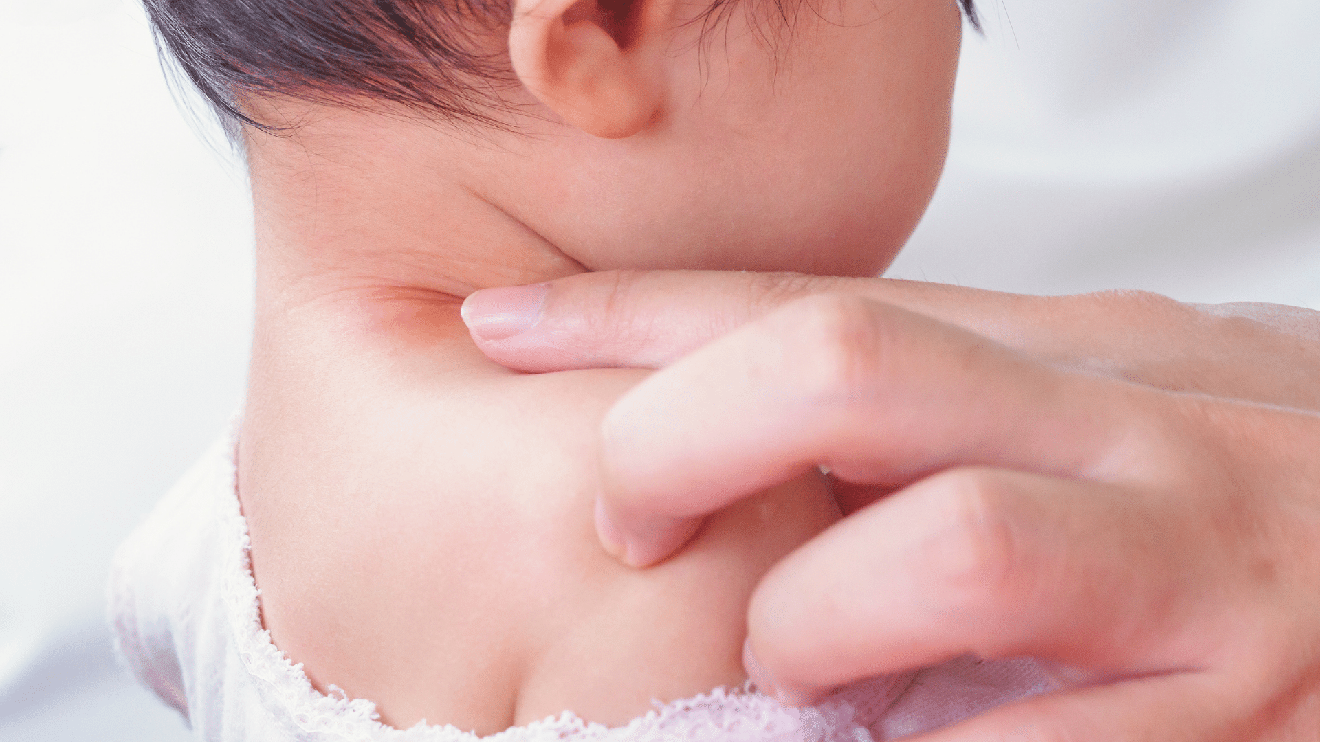 Зуд лица шеи. Коженные заболевания у детей. Лишай на коже у новорожденного.