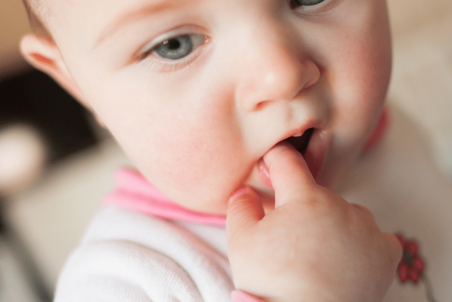 bebeklerde dudak bagi nasil anlasilir