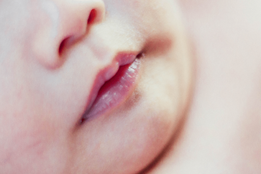 bebeklerde dudak bağı nedir?